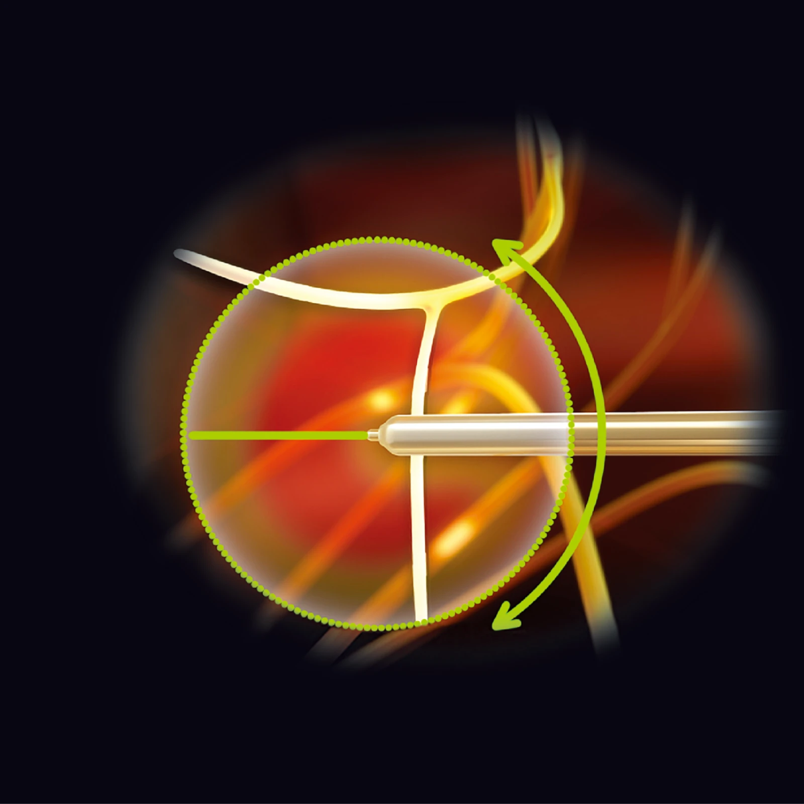 なぜ膝の痛みに効果があるのか