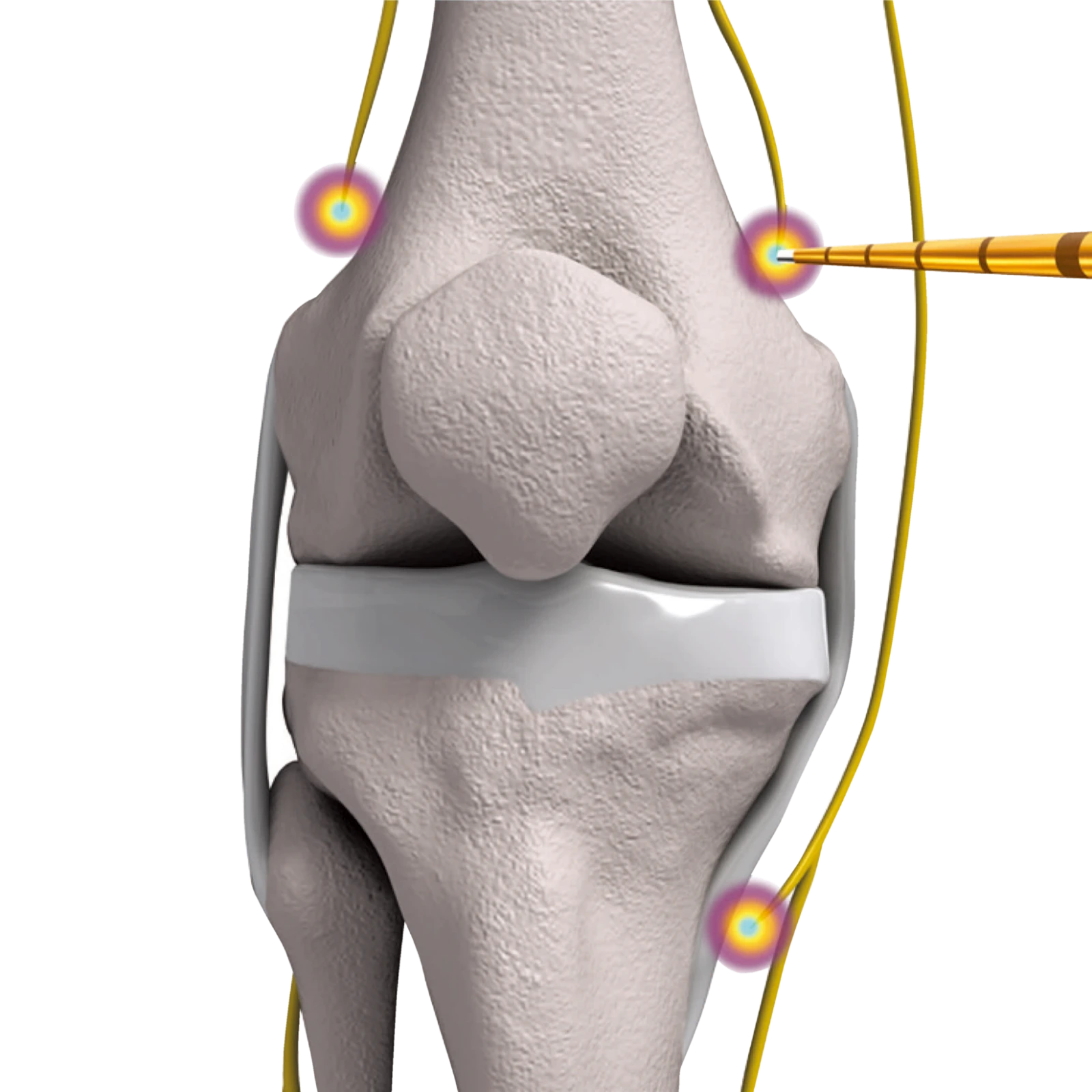 なぜ膝の痛みに効果があるのか